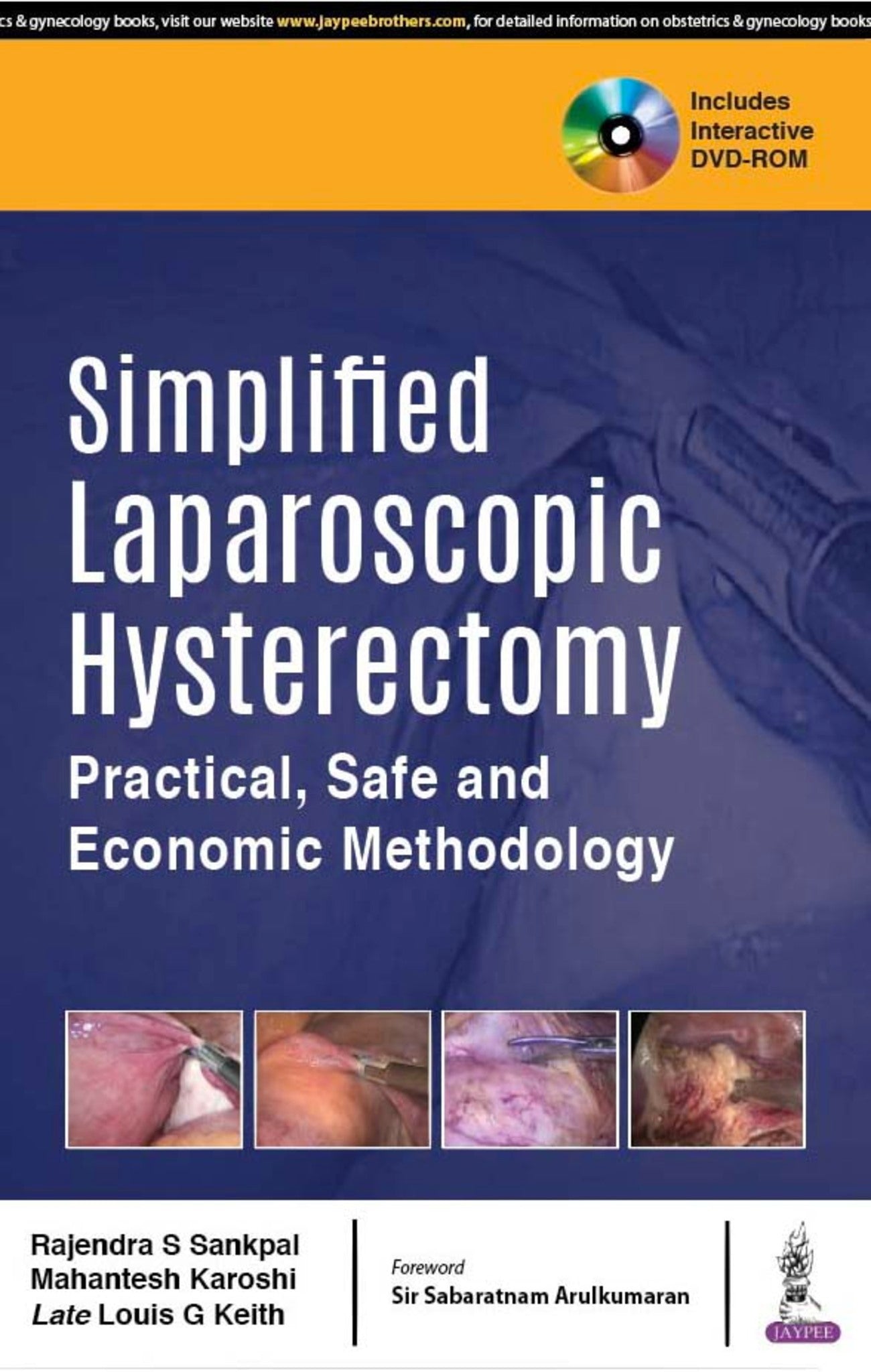 Simplified Laparoscopic Hysterectomy